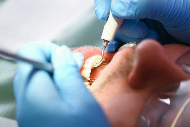 Best Emergency Dentist for Lost Fillings or Crowns in Elmwood Park, IL
